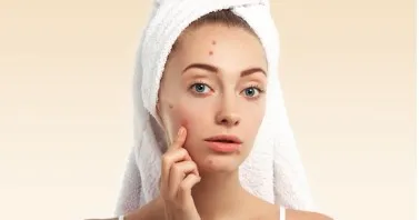 [Edcosmetology] Работа с жирной кожей (Анна Гордеева)