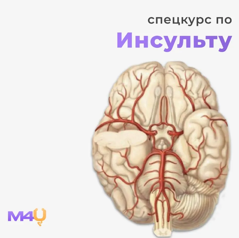 [Medforyou - школа медицины] Спецкурс по инсульту