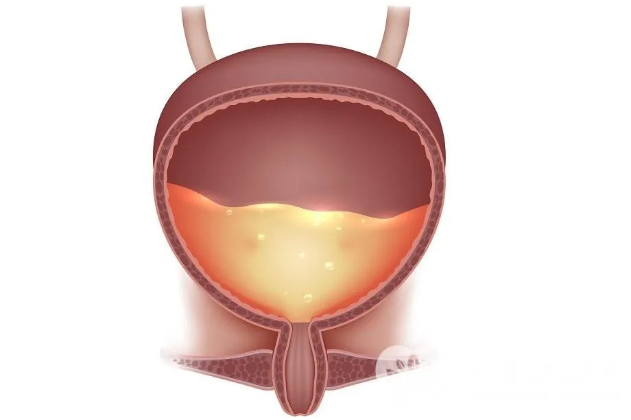 Коррекция мочевого пузыря (Юджиния Квант)