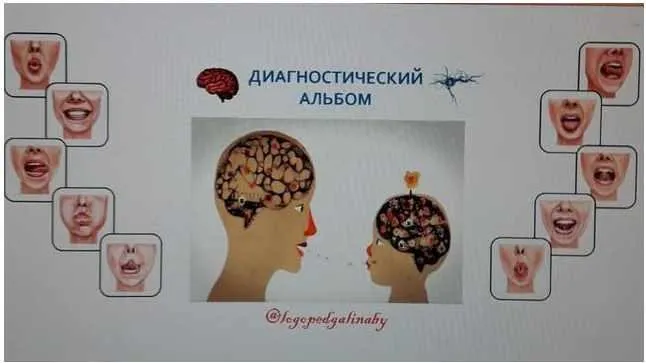 [logopedgalinaby] ЛогоКурс. Диагностический альбом