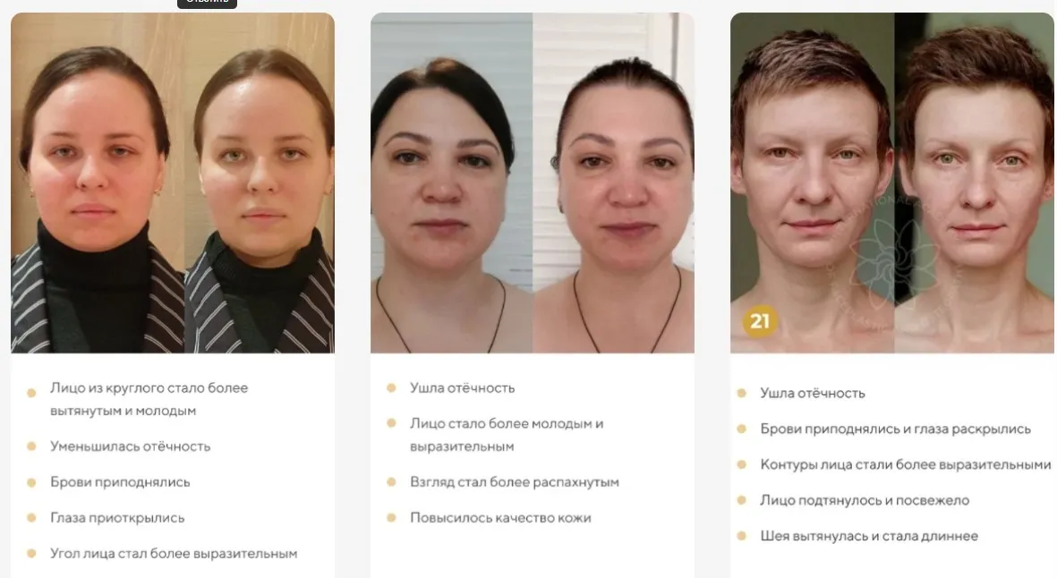 [Международная Академия фейспластики и остеопатии] Отекам Нет. Январь 2022 (Алесь Улищенко)