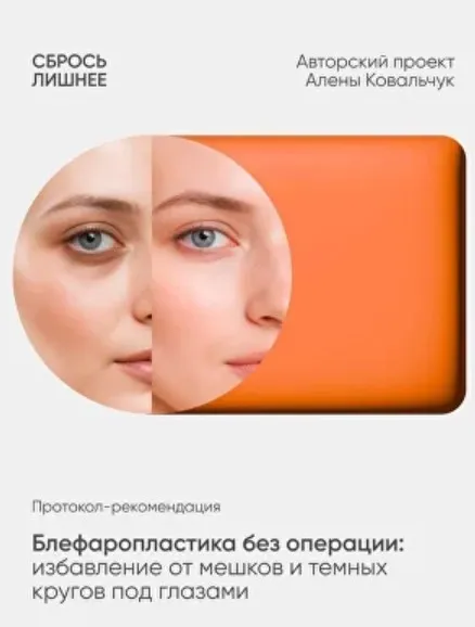 Протокол-рекомендация Блефаропластика без операции (Алена Ковальчук)