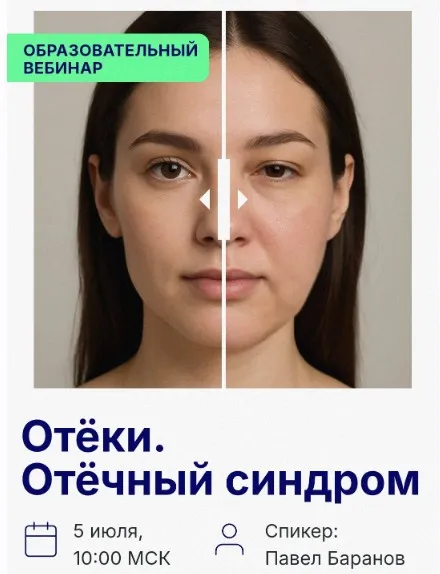 Отёки. Отёчный синдром (Павел Баранов)