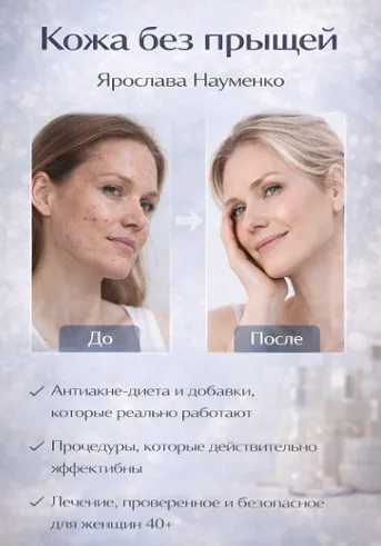 Кожа без прыщей (Ярослава Науменко)