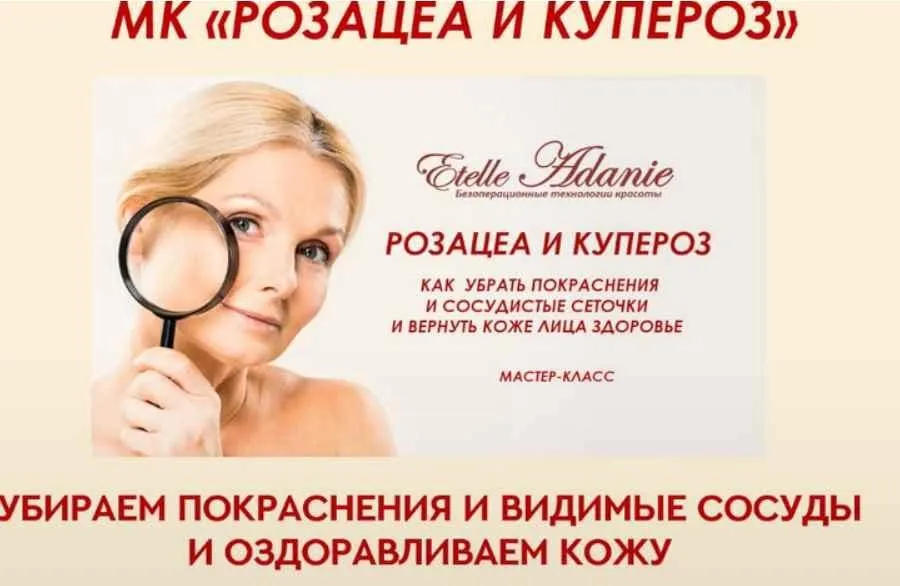 Розацеа и Купероз. Тариф - Розацеа + Купероз (Этель Аданье)