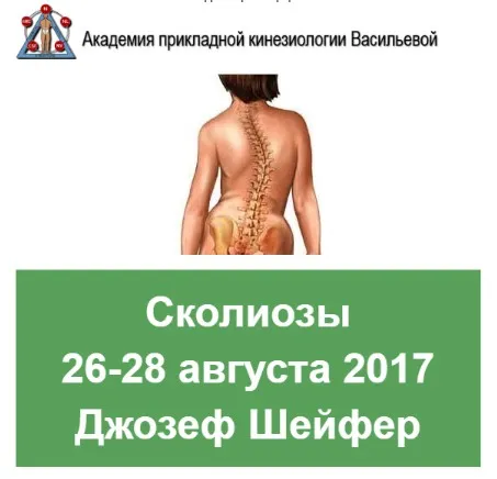 Сколиозы (Джозеф Шейфер)