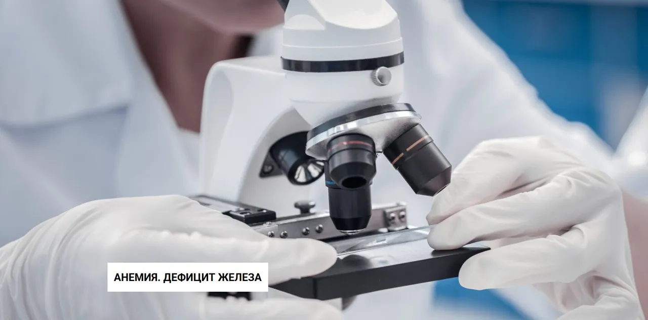 Анемия. Дефицит железа (Валентина Скороход)