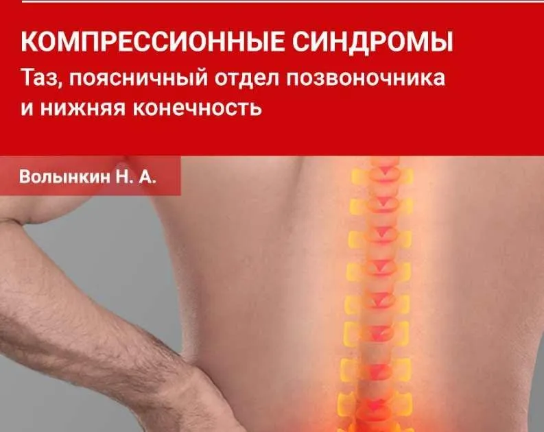 Компрессионные синдромы таза, поясничного отдела позвоночника и нижней конечности (Николай Волынкин)