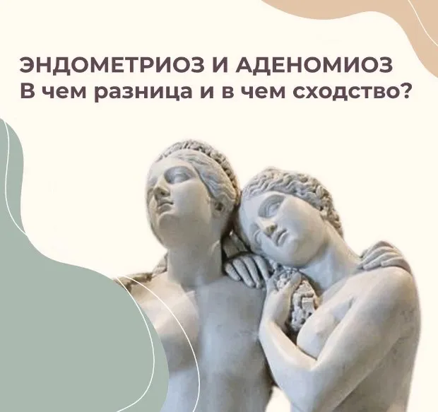 Эндометриоз (Элисо Джобава)