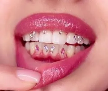 [shinesmilebox] Скайсы