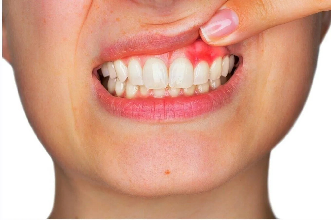[Sigh Energy] Регенерация десен Powerful Plus + 11x (Extra Strong). Gums Regeneration Powerful Plus +11x(Extra Strong)