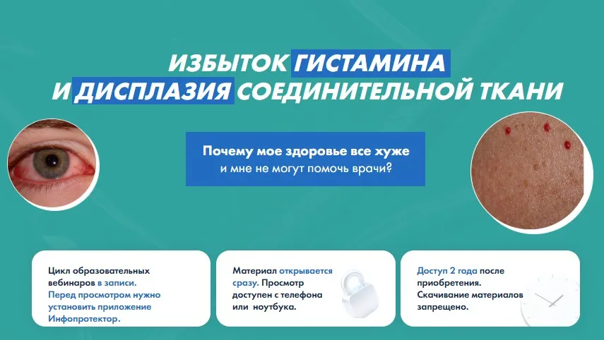 Избыток гистамина и дисплазия соединительной ткани (Дарья Ермишина)