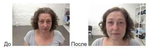 Биомеханика старения лицевых мышц. Самомассаж (Татьяна Шубина)
