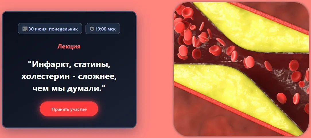 [humberto 2.0] Инфаркт, статины, холестерин - сложнее, чем мы думали (Валерий Подрубаев)
