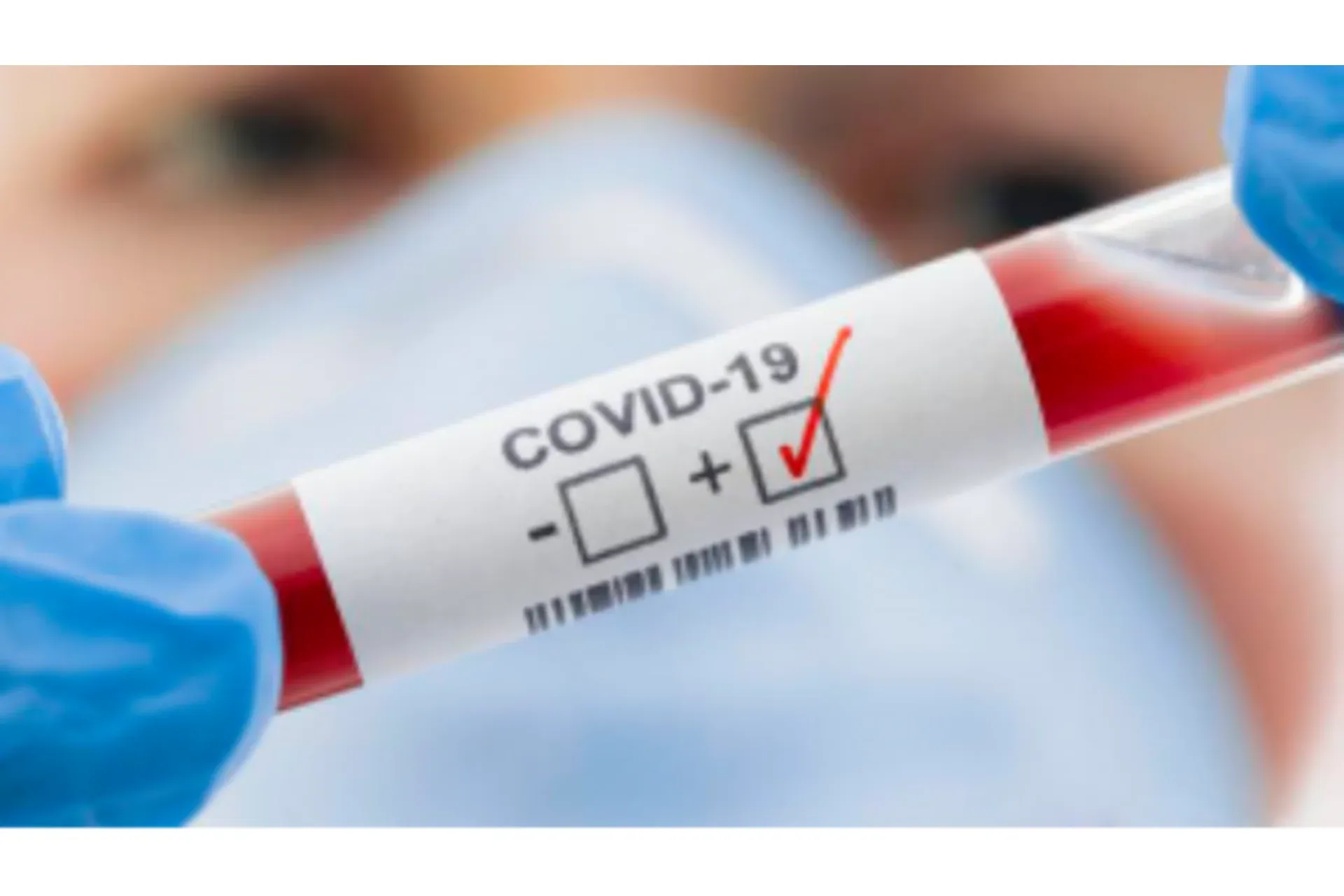 Covid 2025: Перспектива добровольного концлагеря (Евгений Гильбо)