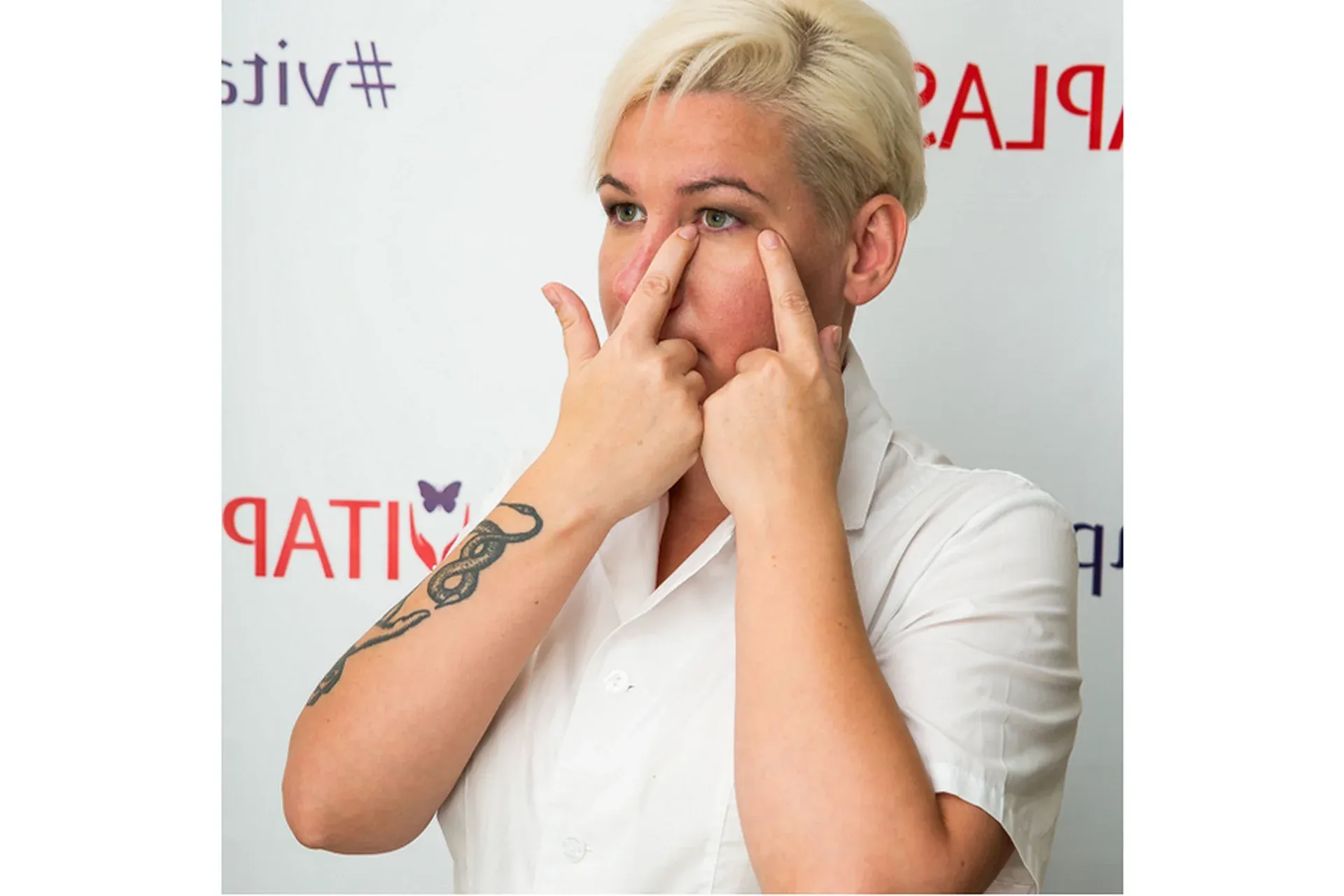 Витапластика для глаз (Надежда Басюбина)