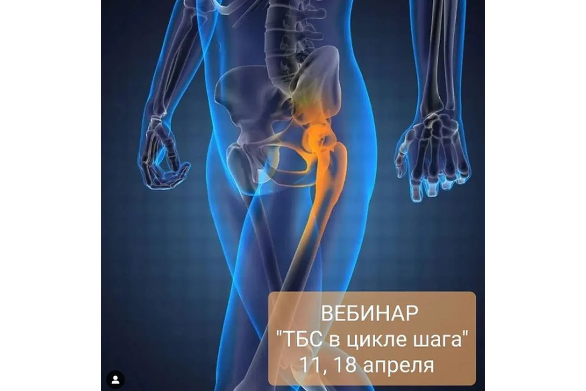 Тазобедренный сустав в цикле шага (Денис Никифоров, Дарья Тропкина)