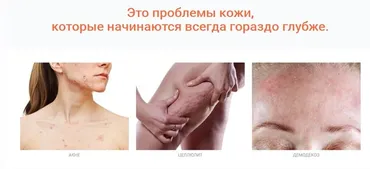 [VitaTeva] Лечебное питание в косметологии (Юлия Резникова)