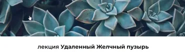 Лекция «Удаленный Желчный пузырь» (Венера Хабирова)