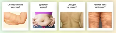 Мастер-класс Антидряблость (Этель Аданье)