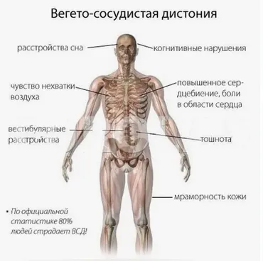 Вегетососудистая дистония от А до Я (Павел Федоренко)