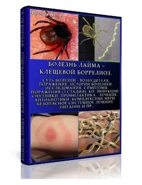 Болезнь Лайма – клещевой боррелиоз. Мини инфопродукт №9 (Юрий Фролов)