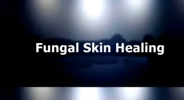 [Sigh Energy] Грибковое заживление кожи. Fungal Skin Healing Powerful Plus +11x (Extra Strong)
