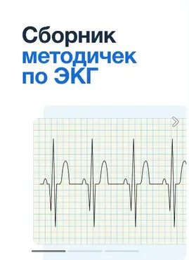 [Synapse] Сборник методичек по ЭКГ
