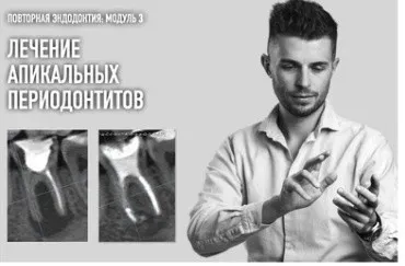Повторная эндодонтия. Модуль 3: Лечение апикальных периодонтитов (Дмитрий Николаев)