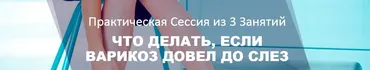 Что делать, если варикоз довел до слез (Наталья Зубова)
