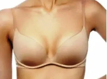 [Sigh Energy] Удаление подмышечной ткани молочной железы / Remove Axillary Breast Tissue Powerful Plus +11x (Extra Strong)