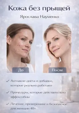 Кожа без прыщей (Ярослава Науменко)