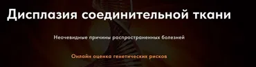 Дисплазия соединительной ткани. Тариф Студент (Карина Ким)