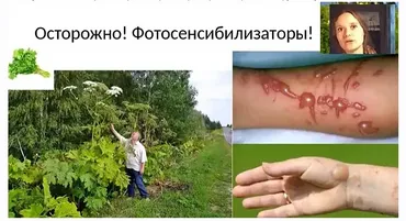Солнцезащитные средства своими руками (Ольга Дзюбан)