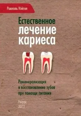 Естественное лечение кариеса (Рамиэль Нэйгел)