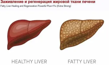 Заживление и регенерация жировой ткани печени (Sigh Energy)