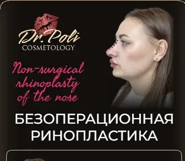 [dr.poli] Безоперационная ринопластика (Полина Еремина)
