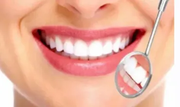 [Sigh Energy] Удаление зубного налета и зубного камня | Plaque and Tartar Removal