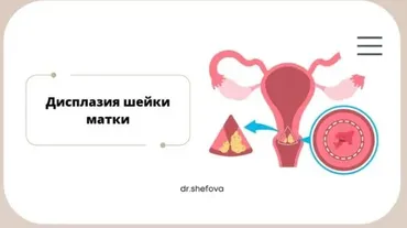 Дисплазия шейки матки (Юлия Шефова)