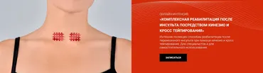 [BBalance] Комплексная реабилитация после инсульта посредством кинезио и кросстейпирования (Валентин Гайт)