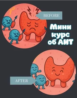 [endo_doc_] Мини курс по АИТ (Лариса Чумак)