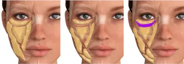 [Sigh Energy] Регулятор жира для лица | Facial fat regulator Powerful Plus +11x (Extra Strong)