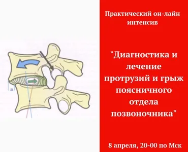 Диагностика и лечение грыж поясничного отдела (Игорь Атрощенко)