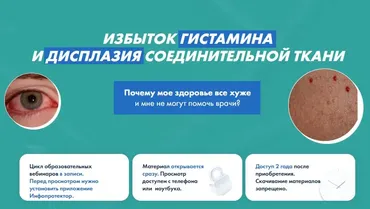 Избыток гистамина и дисплазия соединительной ткани (Дарья Ермишина)