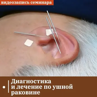 Диагностика и лечение по ушной раковине. Лечение зависимостей (Владимир Кононов)