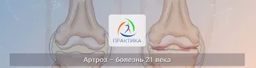 [Practica center] Артроз – болезнь 21 века (Екатерина Смыгина)