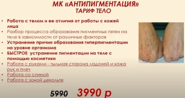 Антипигментация. Тело (Этель Аданье)