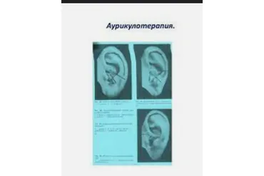 Клиническая аурикулотерапия (Елена Шведова)