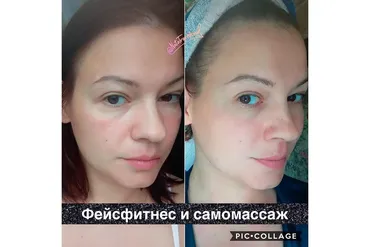 Фейсфитнес и самомассаж (Наталья Травникова)