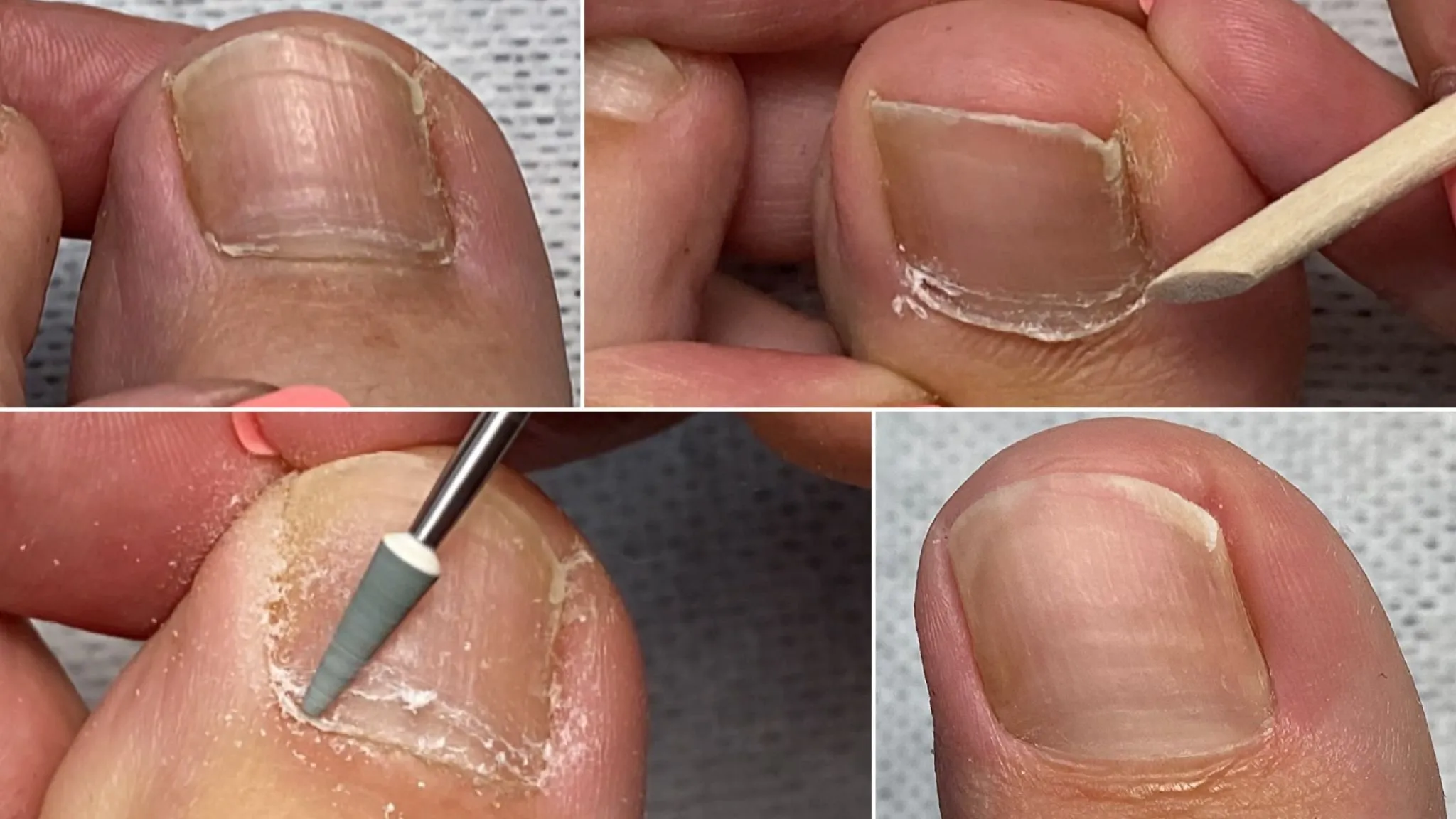 Аппаратный педикюр. Второй поток (judi_nails)